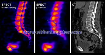 Tungsten Heavy Alloy Collimator tungsten heavy alloy collimator applied for SPECT picture